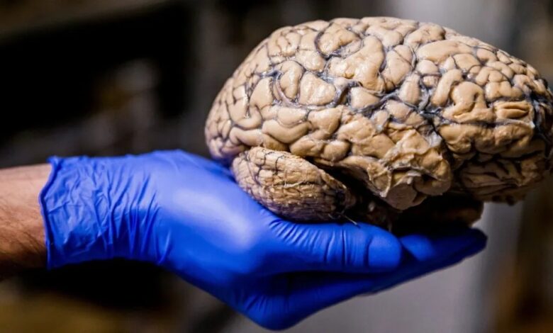 Inflamación, hemorragias, lesiones: Así daña COVID al cerebro, incluso en casos leves